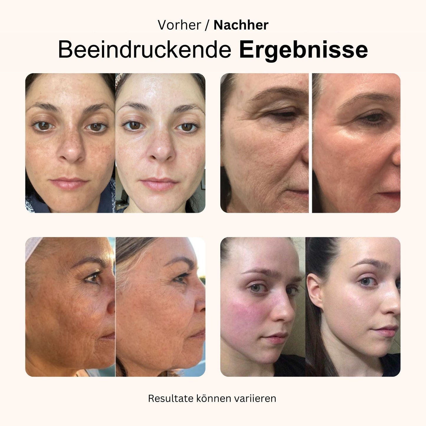 VitalGlow Lichtstab + Komplex Serum